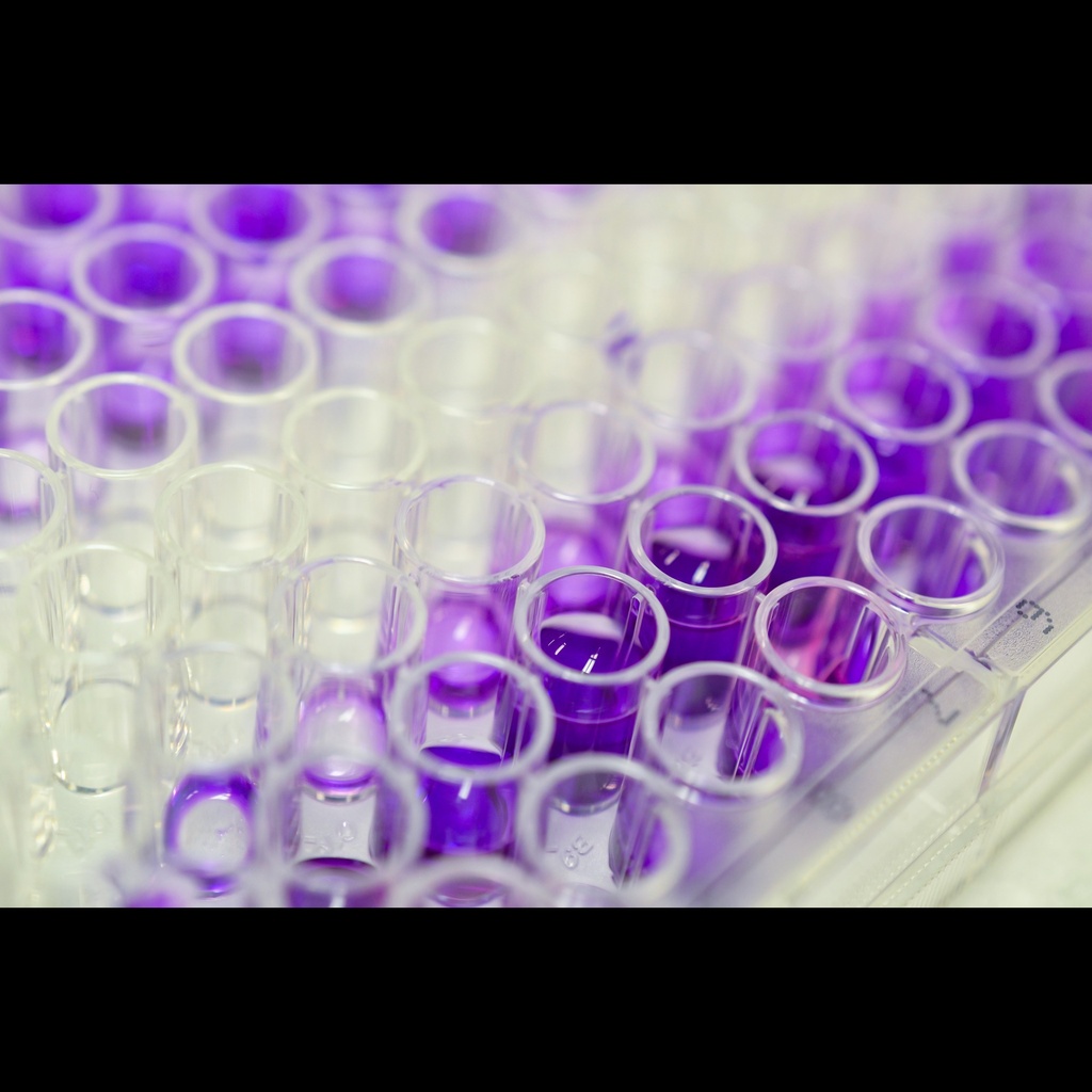Rabbit Antisize:Influenza B virus IgG ELISA kit, Quantitative size: 96 tests