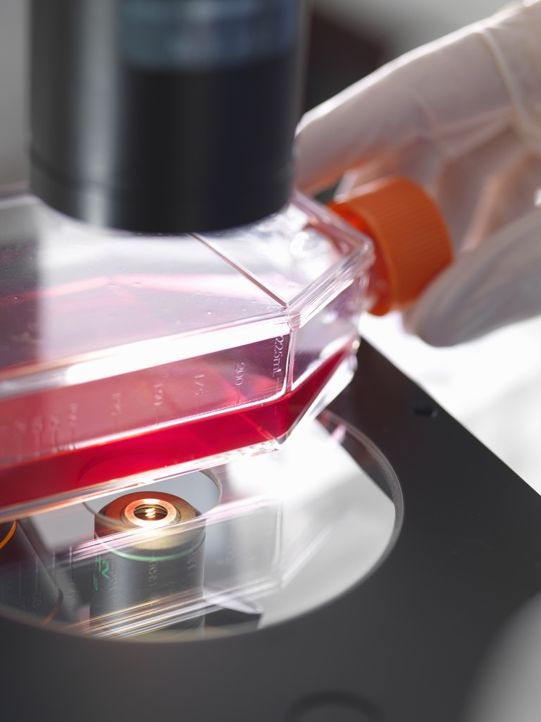 Human Lens Epithelial Cells (HEL-B3)