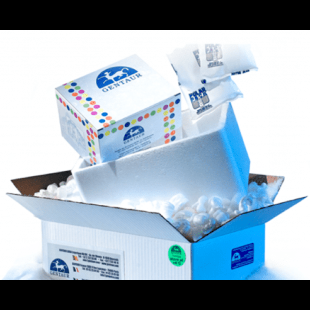 100 μl Filter Universal Pipette Tips, Racked, Sterile, 96/pk, 960/box, 4800/cs